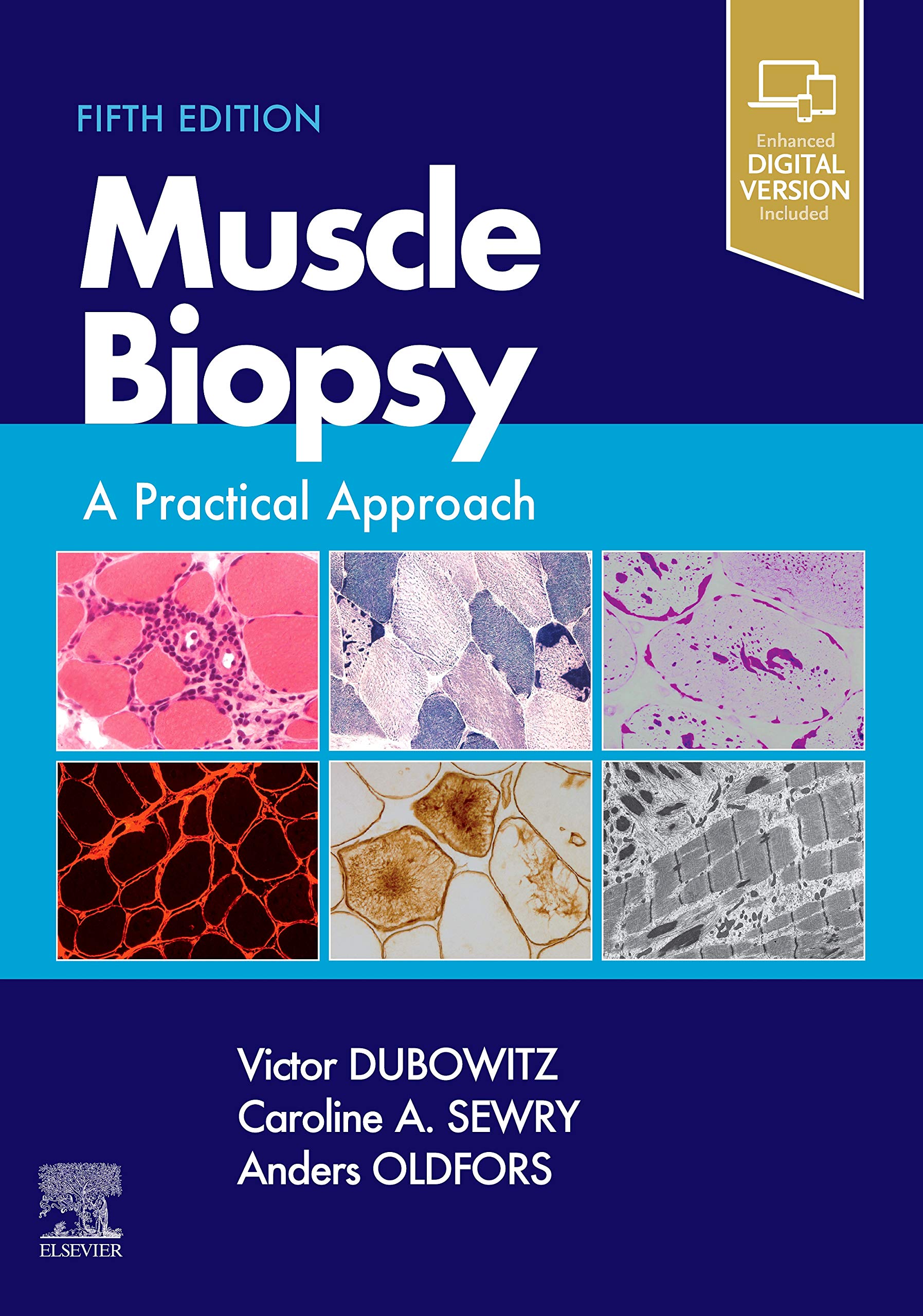 Muscle Biopsy: A Practical Approach 第5版 Buy Muscle Biopsy: A Practical Approach Book Online at Low Prices