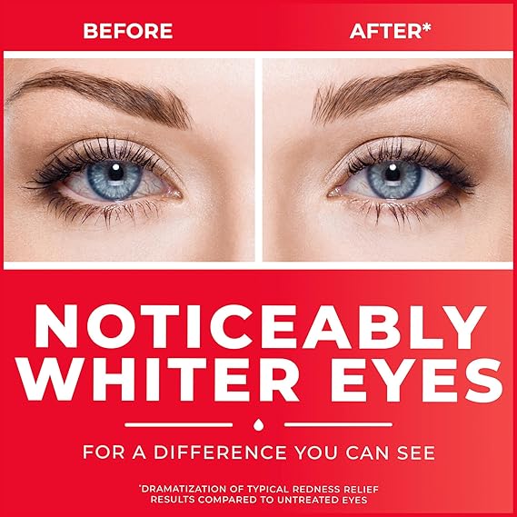 قطرات العين Clear Eyes Redness Relief Eye، 0.5 Fl Oz، حزمة من 3