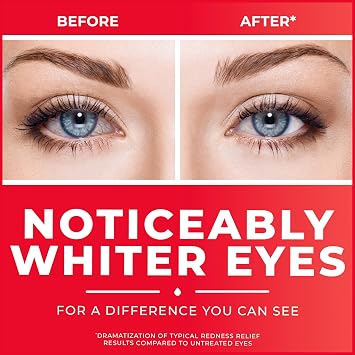 قطرات العين Clear Eyes Redness Relief Eye، 0.5 Fl Oz، حزمة من 3