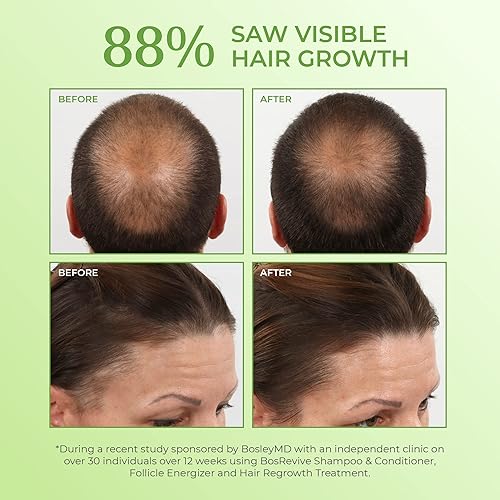 Miniatura 4 de BosleyMD Follicle Energizer Foil 3 ml, 0.1 fl oz