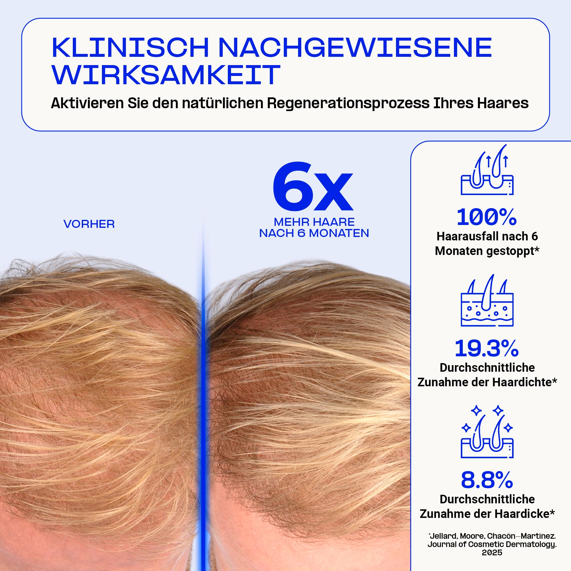 Wearable, klinisch geprüftes Gerät gegen Haarausfall mit innovativer Stammzell-Reaktivierung, moderne Technologie zur natürlichen Haarregeneration mit Erfolgsgarantie