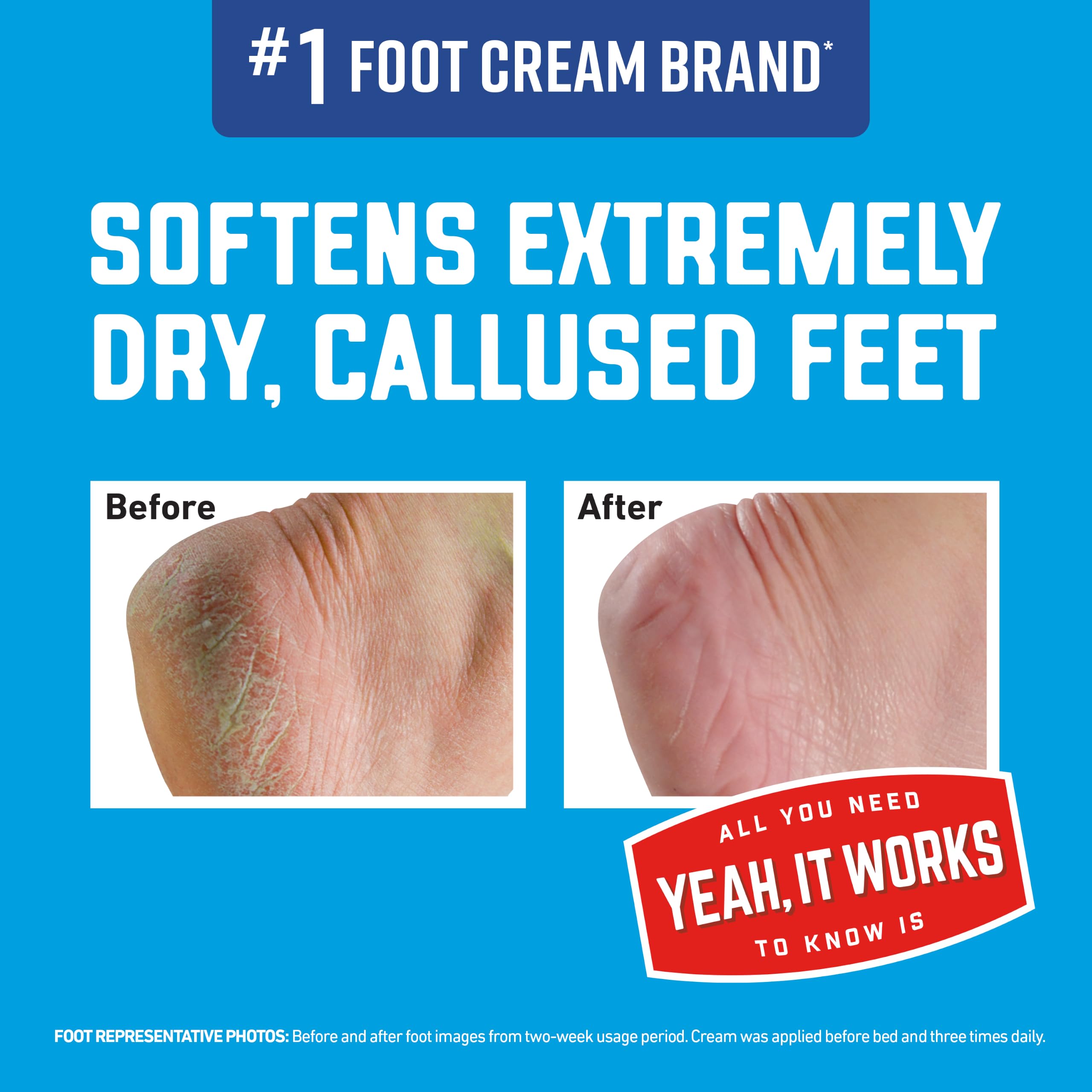 O'Keeffe's Healthy Feet Renewal Cream - Soft, Smooth Feet -3 O'Keeffe's Healthy Feet Renewal Cream - Soft, Smooth Feet -3