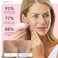 Vista 42 de PMD Personal Microderm Pro - At-Home Microdermabrasion Machine with Kit for Face & Body Exfoliating Crystals and Vacuum Suction for Fresh, Radiant