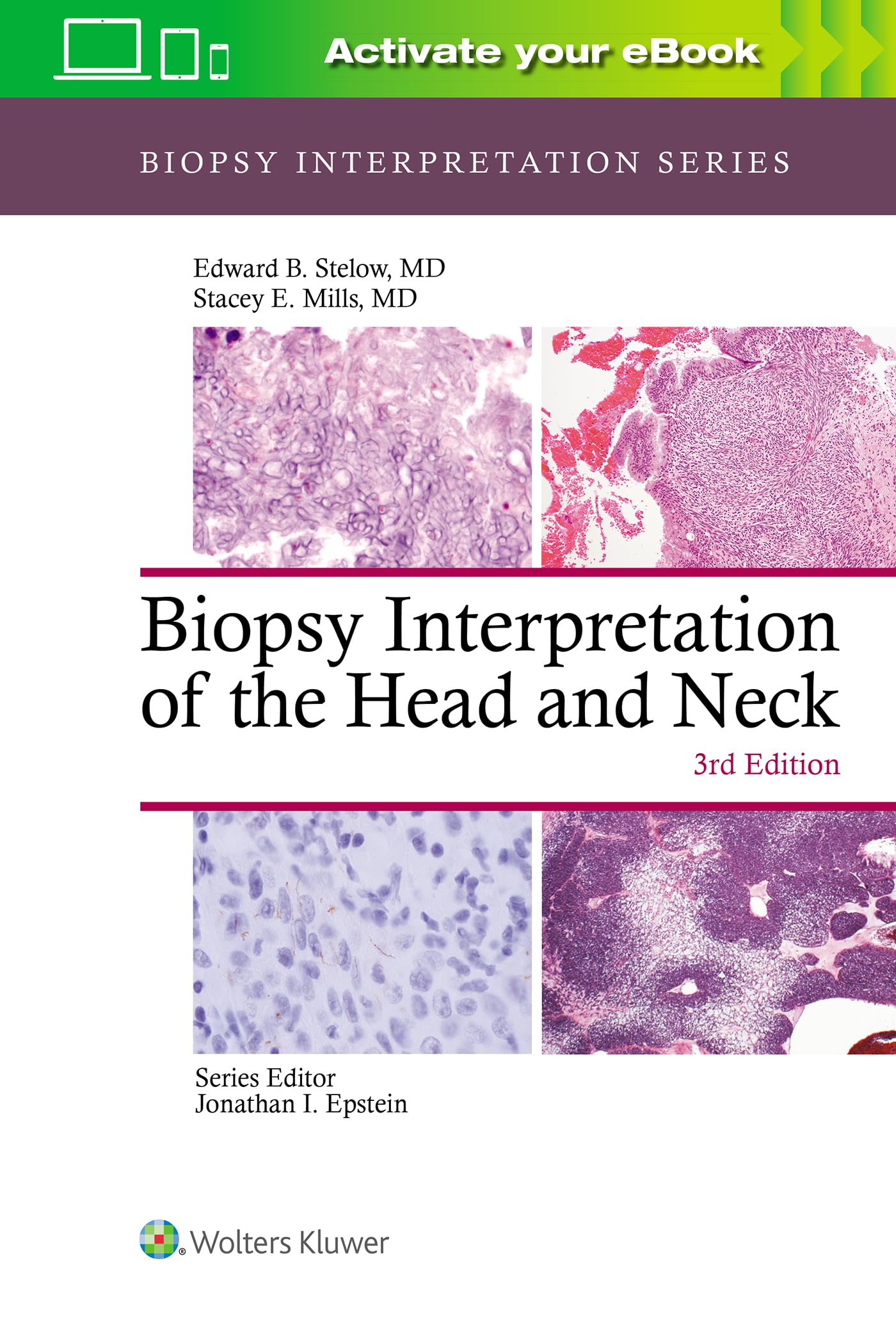 Biopsy Interpretation of the Head and Neck (Biopsy Interpretation Series)