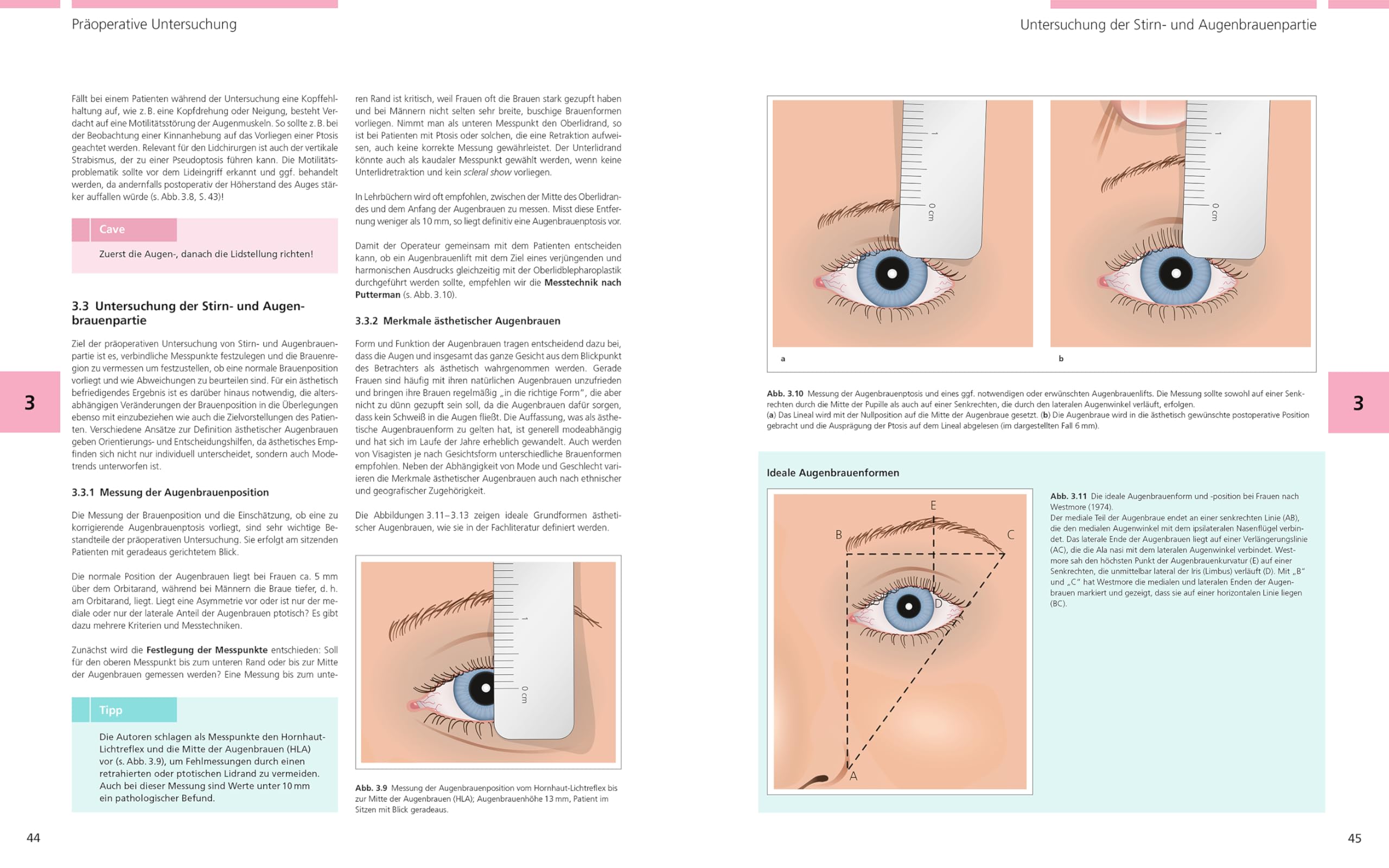 Bildatlas Lidchirurgie: Angewandte Anatomie | Untersuchung | Plastische Lidchirurgie