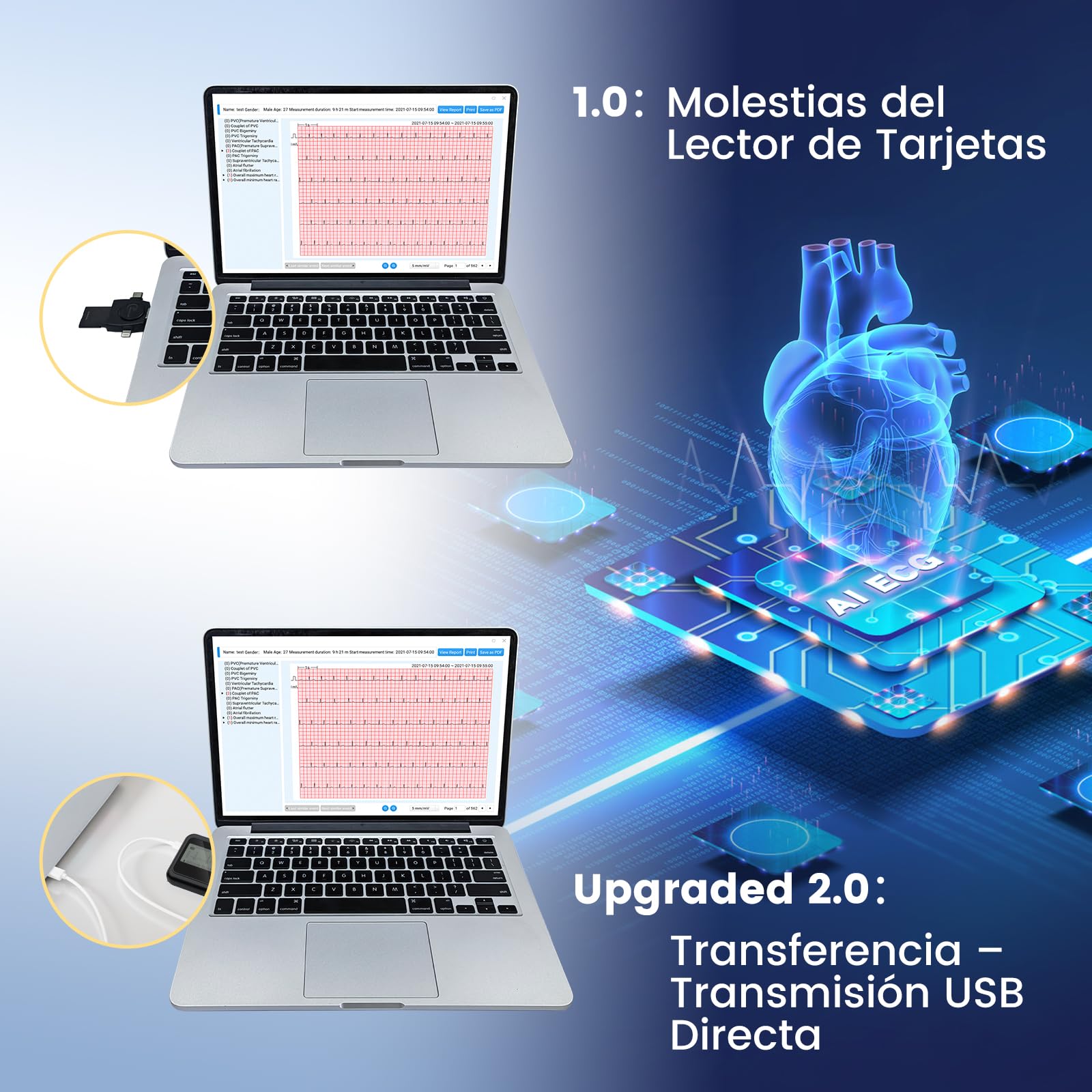 CheckMe 2026 ECG Aggiornato per Casa & ECG 12 Derivazioni – Analisi IA Potente e Registrazione Completa 24h: Monitor Holter Portatile per Monitoraggio Cardiaco Continuo con Software PC/Mac
