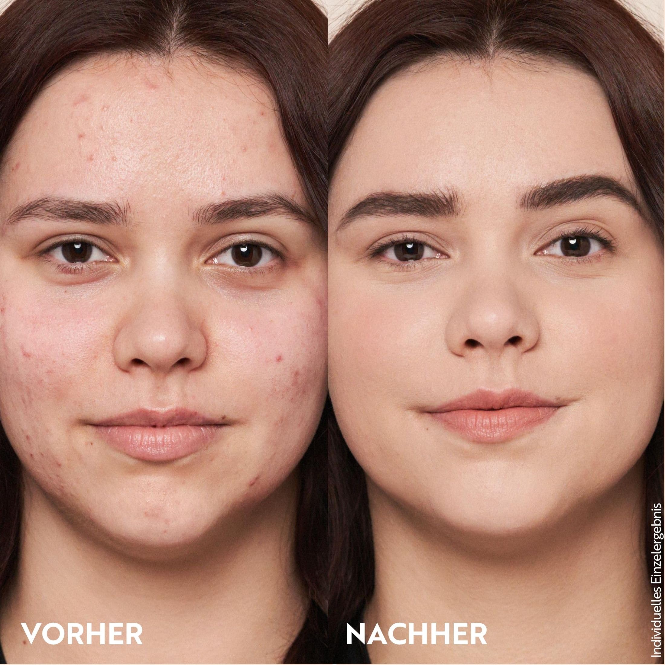 M. Asam Magic Finish Make Up Mousse Classic (30ml), 4-in-1 Primer, Make up, Puder & Concealer, Kaschiert, Gleicht aus, Verschönert & Perfektioniert - Für helle bis mittlere Haut, Vegan