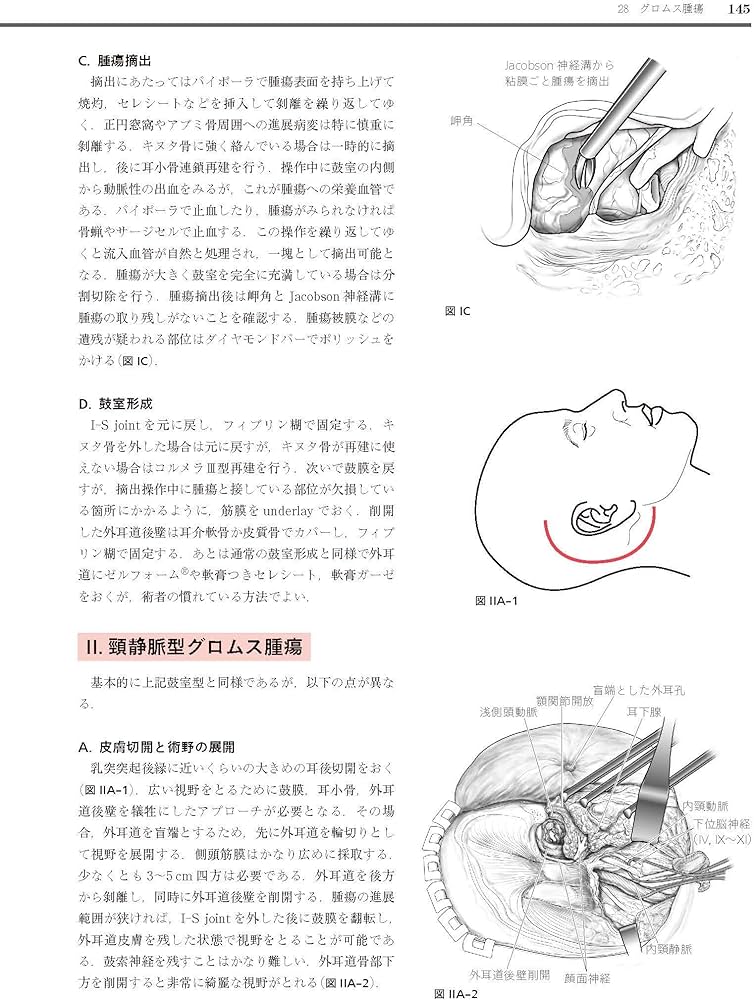 耳鼻咽喉・頭頸部手術アトラス[上巻] 第2版 | 森山 寛 |本 | 通販 | Amazon