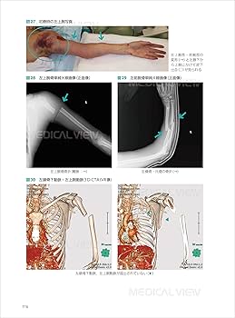 病気がみえる　テコム　症候•病態からのアプローチ　セット 病気がみえる テコム 症候•病態からのアプローチ セット