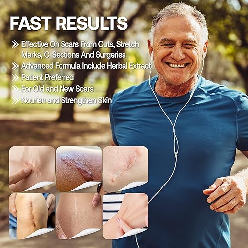Miniatura 4 de Crema para cicatrices de máxima fuerza para cicatrices corporales antiguas y nuevas trata la cicatriz de las estrías de la cesección