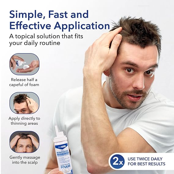 Hair Regen Minoxidil Foam for Men 5% Percent - Men's Hair Growth Treatment for Him- Topical Foaming Minoxidil for Men- Great for Hair Regrowth and Reduce Hair Loss - 6 Pack as 6 Months Supply