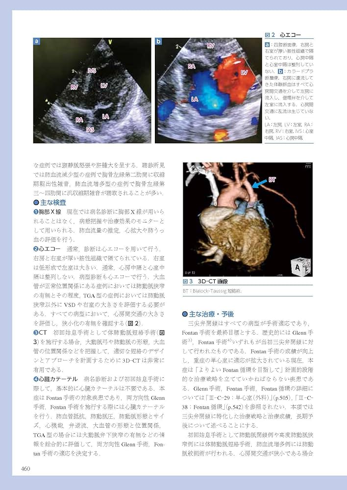 Amazon.co.jp: 小児・成育循環器学 改訂第2版 : 日本小児循環器