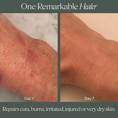 Miniatura 6 de Doctor Rogers Restore Bálsamo curativo  Ungüento multiusos vegano para aliviar la piel seca y agrietada, cortes menores y quemaduras, como se ve en