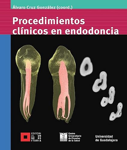 Procedimientos clínicos en endodoncia (Spanish Edition)