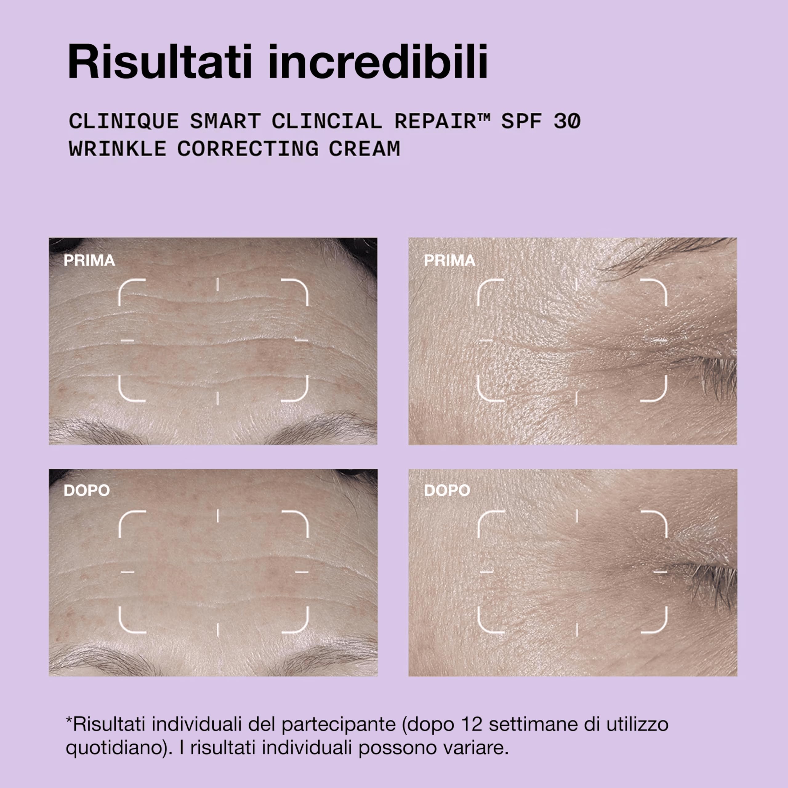 Clinique Smart Clinical Repair SPF 30 Wrinkle Correcting Cream | Crema Idratante anti-Age, 50 ml