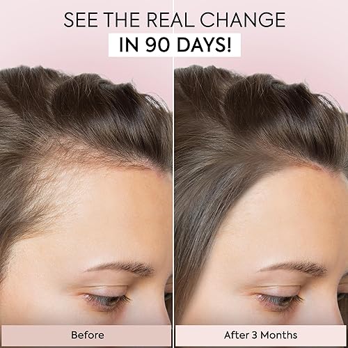 Miniatura 2 de Suero para el crecimiento del cabello aceite natural para el crecimiento del cabello veganic, tratamiento de pérdida de cabello para mujeres y