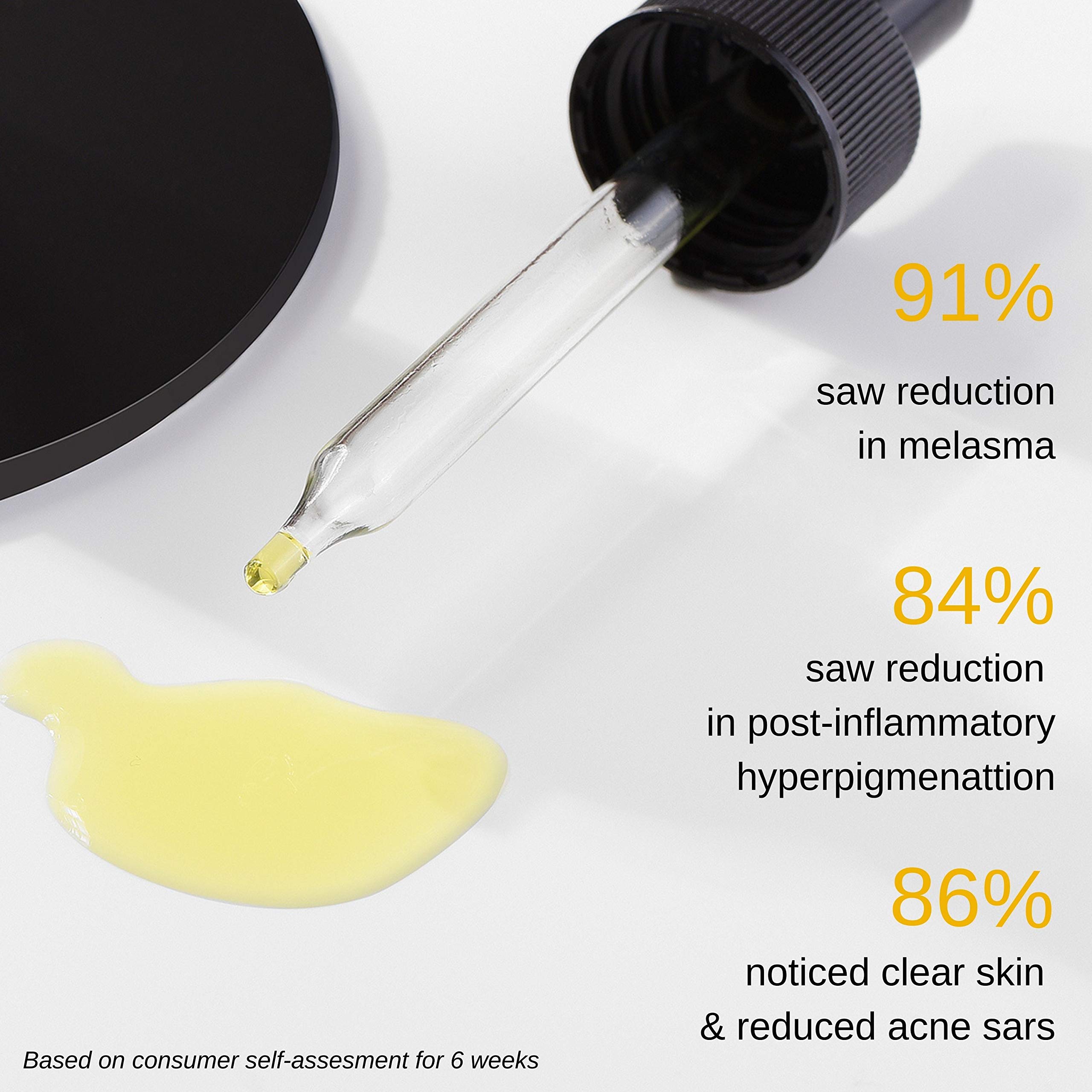 Buy Minimalist 3 Tranexamic Acid Face Serum for Pigmentation& Acne