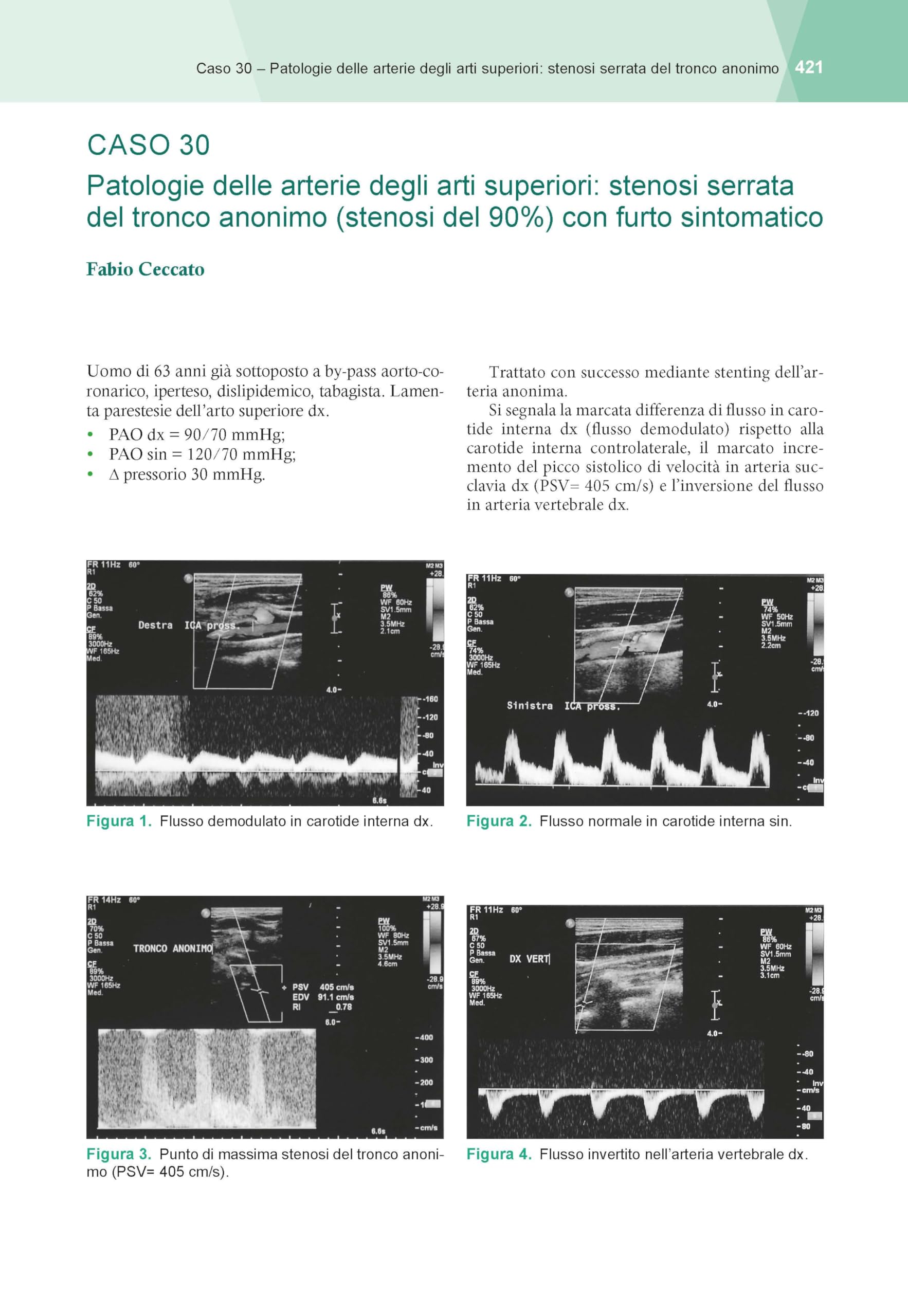 Ultrasonografia vascolare. Con video clip didattiche online