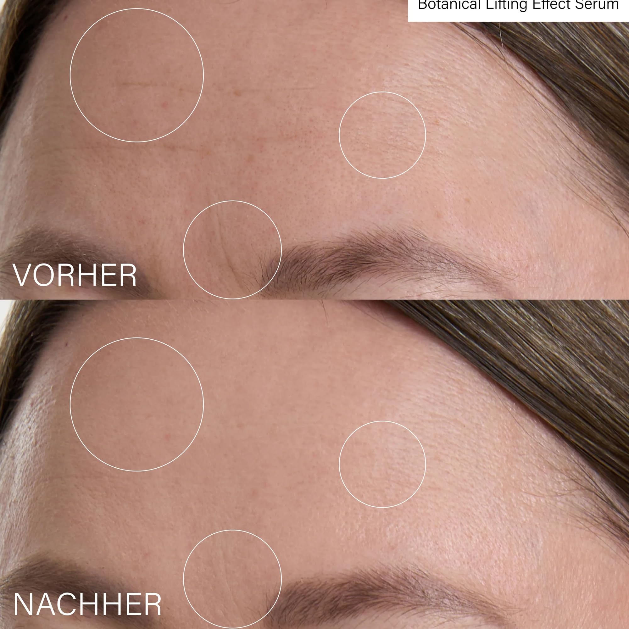 Rosental Microneedling Lifting Effect Set – Gesichtspflege Set mit Microneedling Effect Treatment 30 ml, Lifting Serum 30 ml & Maske 50 ml – für ein glatter wirkendes Hautbild