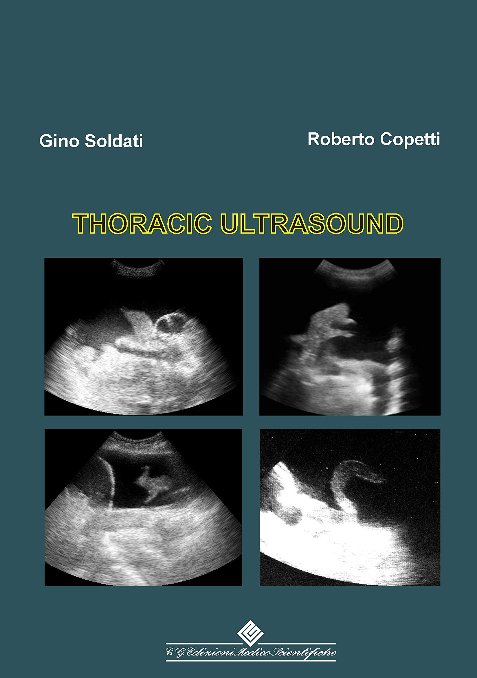 Thoracic Ultrasound (English Edition)