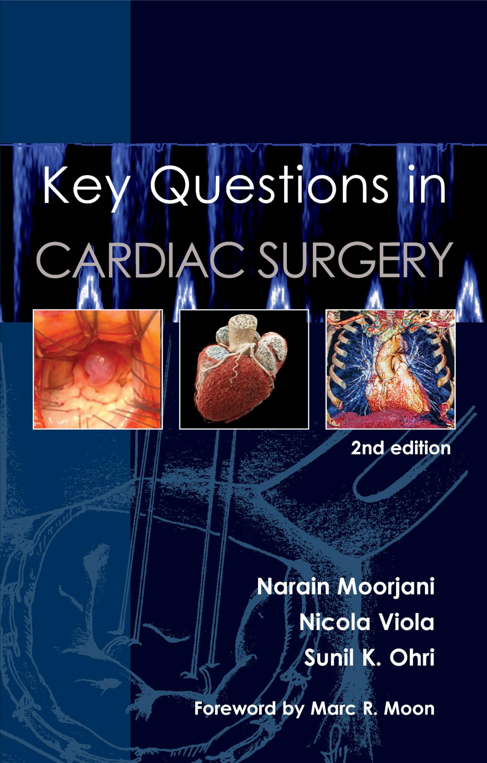 Key Questions in Cardiac Surgery: Moorjani, Narain, Viola, Nicola