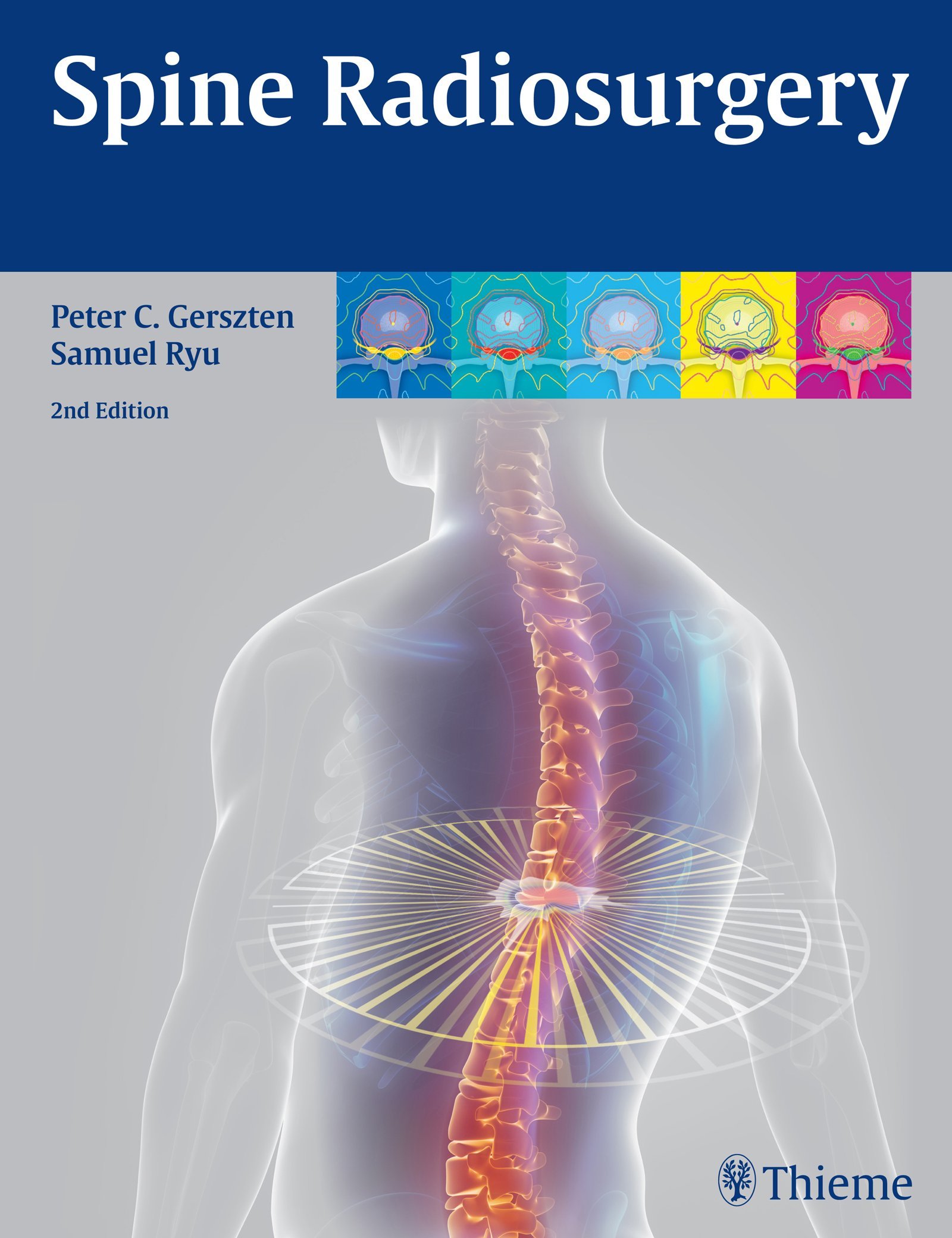 Buy Controversies in Stereotactic Radiosurgery: Best Evidence Recommendations — BookShops.in