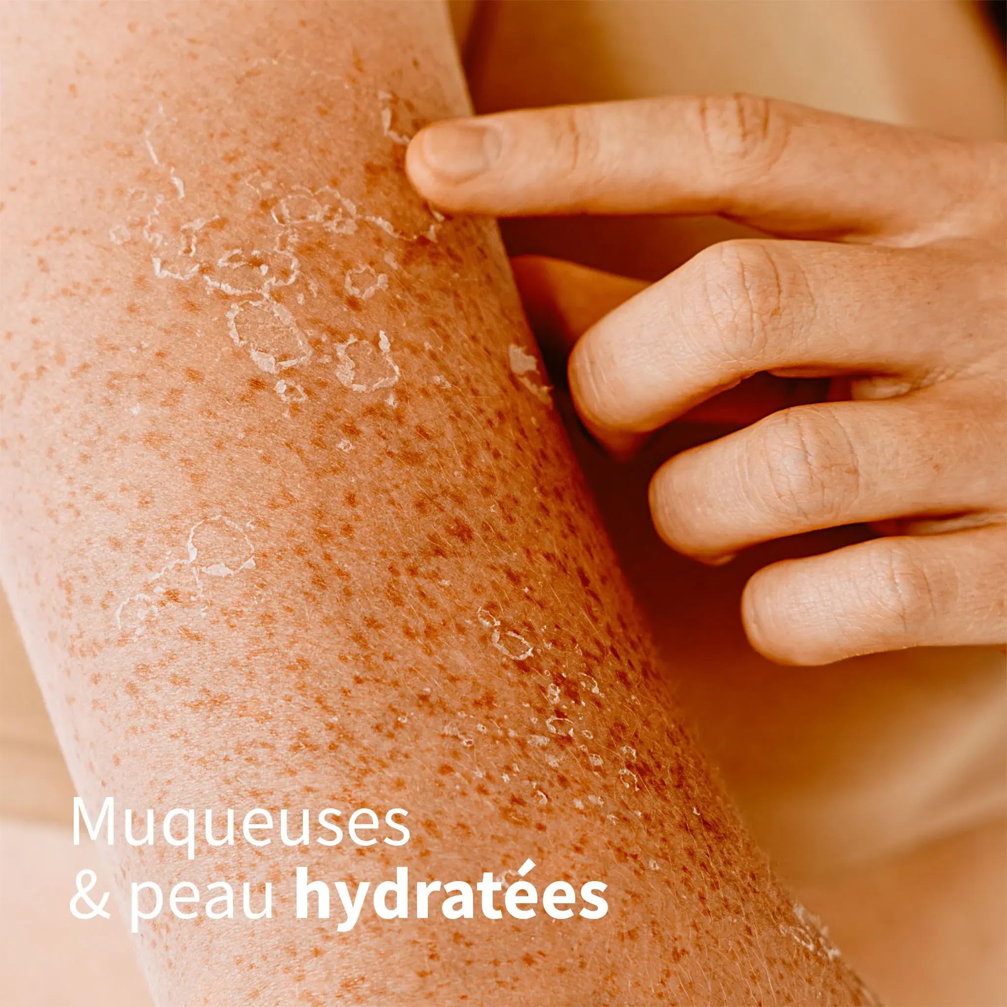 NUTRIGÉE – Hydra-FORT - Hydratation Peau & Muqueuses - Sécheresse Vaginale, Oculaire & Peau Déshydratée – Concentration Oméga 7-60 Capsules – 30 jours