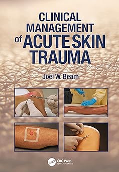 Clinical Management of Acute Skin Trauma-Wow! eBook