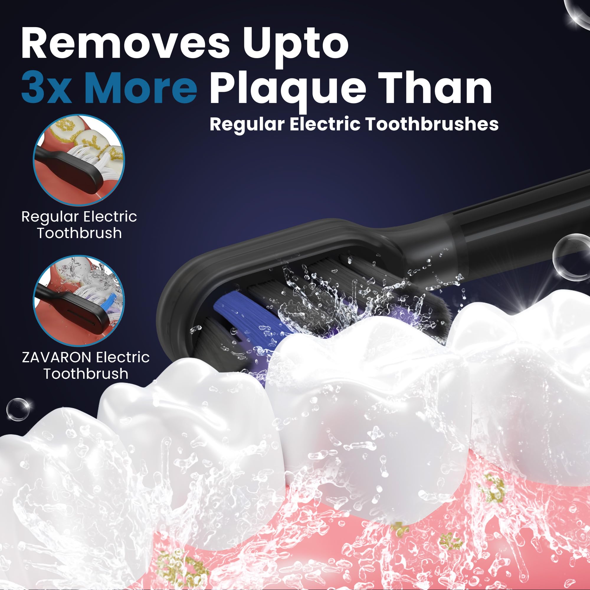 Sonic Spazzolino elettrico per adulti - Spazzolino da denti ricaricabile con 31.000 VPM e 180 oscillazioni/min, 5 modalità, modalità volo, 6 testine, custodia da viaggio, caricabatterie base