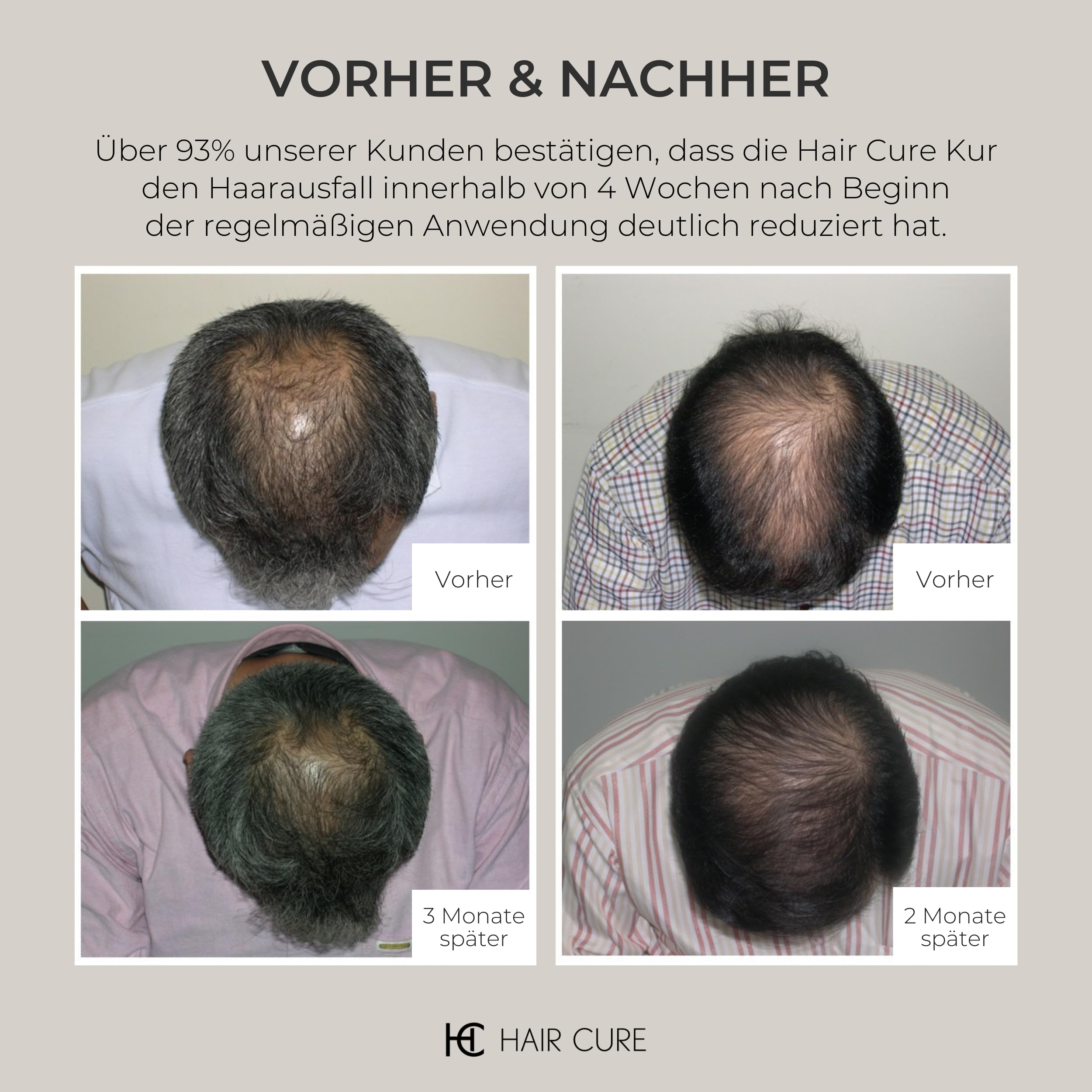 Hair Cure® Haarserum für Haarwachstum für Frauen & Männer - 150 ml - Anti Haarausfall Serum - Haarwachstum Beschleunigen Serum - 16 aktive Inhaltsstoffe & 3 Peptide