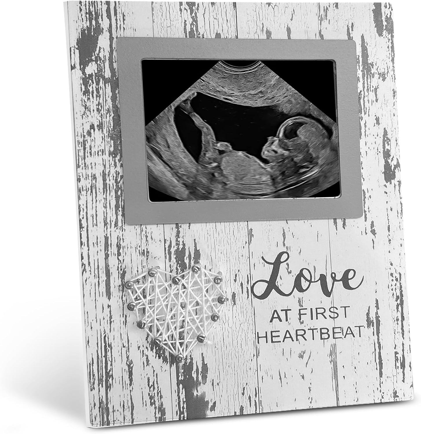 bloom & nest Baby Keepsake Sonogram Frame – ‘Love at First Sight’ Ultrasound Photo Frame, Pregnancy Announcement & New Parent Gift