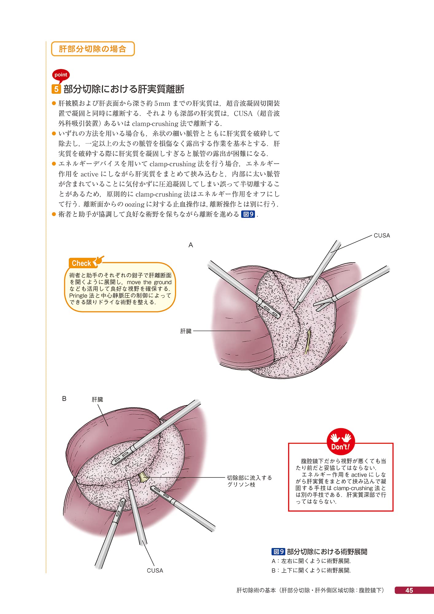消化器外科手術 肝臓 脾臓 標準手技をイラストと動画で学ぶ ビジュアルサージカル 山本 雅一 上西 紀夫 正木 忠彦 遠藤 格 消化器外科手術 肝臓 脾臓 標準手技をイラストと動画で学ぶ ビジュアルサージカル 山本 雅一 上西 紀夫 正木 忠彦 遠藤 格
