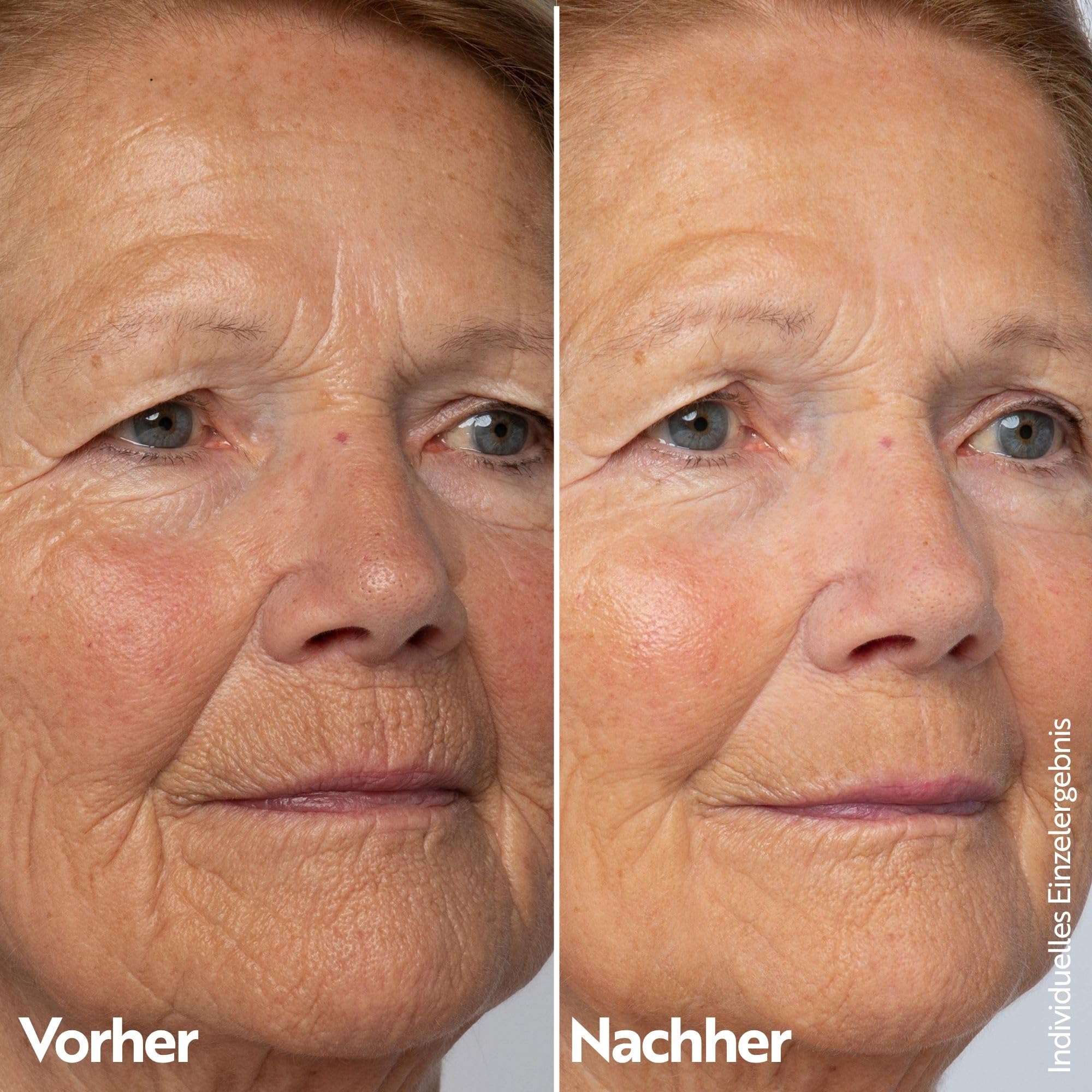 M. Asam Retinol Intense Youth Concentrate (100 ml) | Retinol Serum Hochdosiert Für Anti Aging Frauen, Straffendes Serum Gegen Falten Und Augenringe