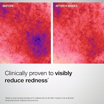 StriVectin Barrier Restore + Soothing Milky Face Mist with Ceramides + Hyaluronic Acid