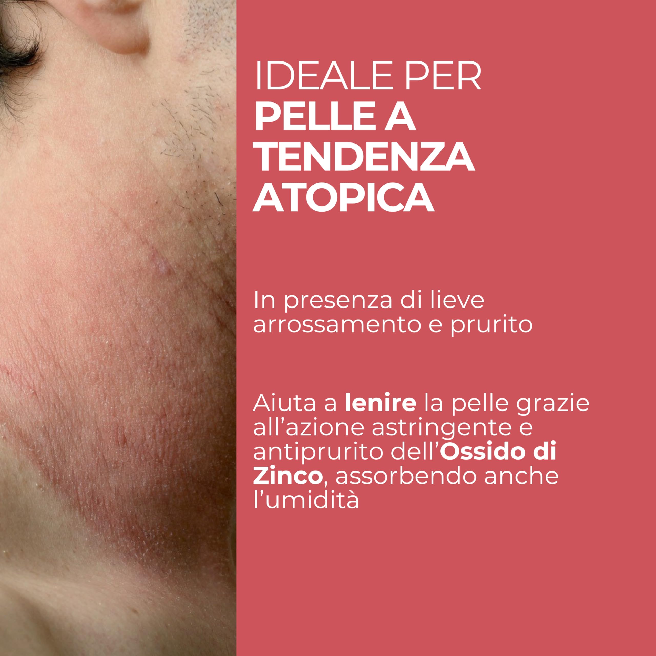 MOST Crema Lenitiva Viso e Corpo 50ml Ossido di Zinco per Pelle Sensibile e Atopica