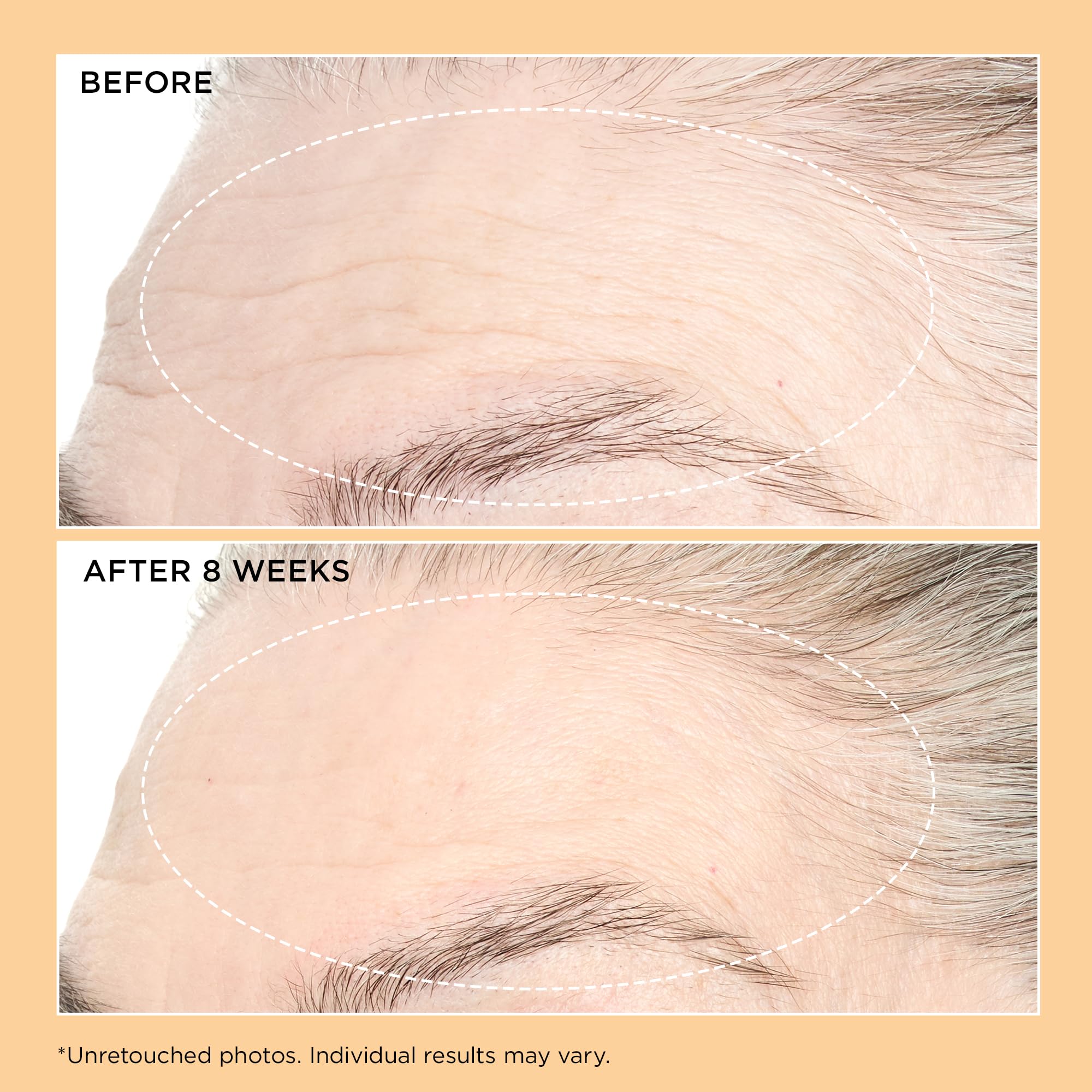 Perricone MD Neuropeptide Pro-Strength Firming Moisturizer, 2 fl oz.