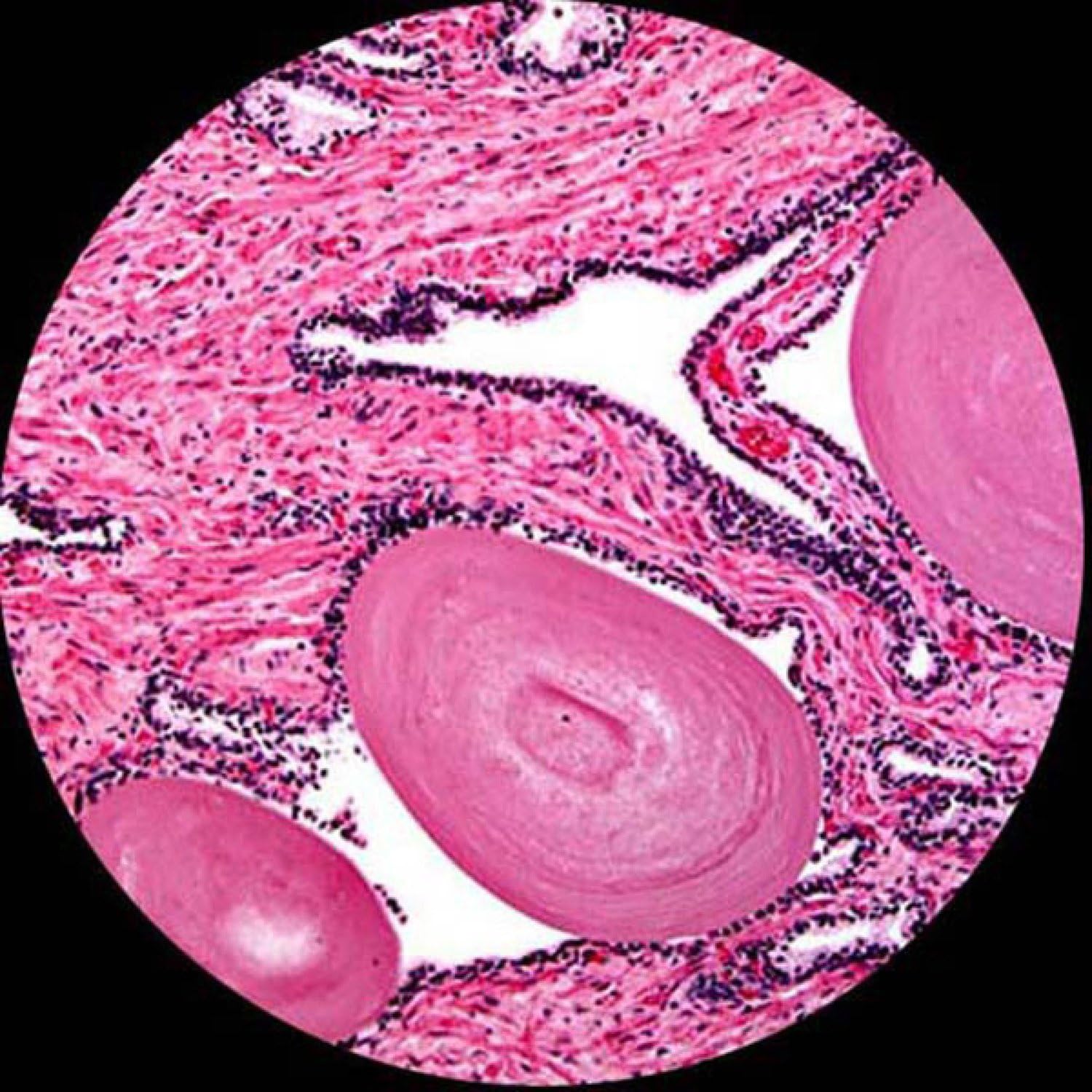 Up To 40% OFF AmScope B120B Siedentopf Binocular Compound Microscope, 40X-2000X Magnification, Brightfield, LED Illumination, Abbe Condenser, Double-Layer Mechanical Stage