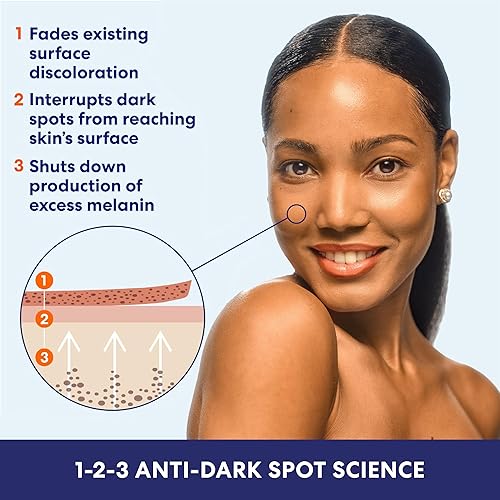 Miniatura 5 de Palmer's Skin Success - Loción corporal antimanchas antimanchas de leche, 8.5 onzas