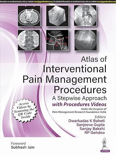 Atlas of Interventional Pain Management Procedures