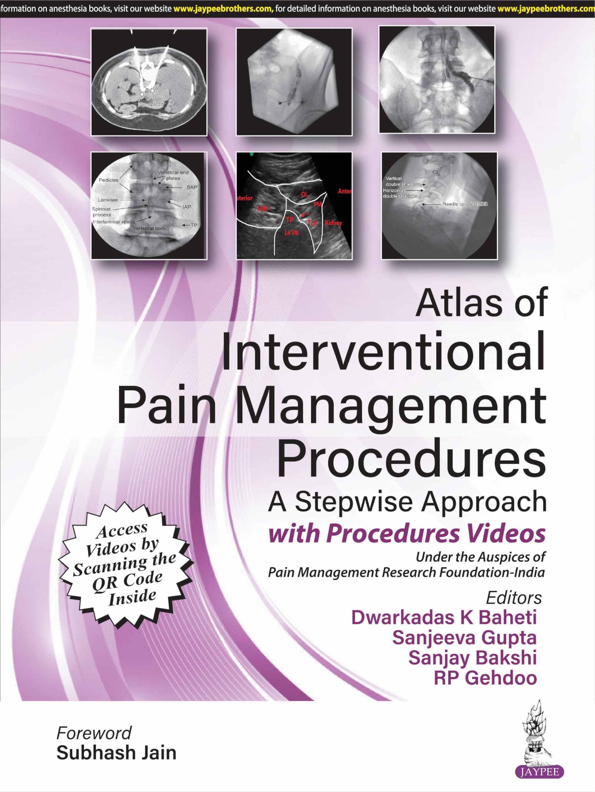 Buy ATLAS OF INTERVENTIONAL PAIN MANAGEMENT PROCEDURES: A STEPWISE
