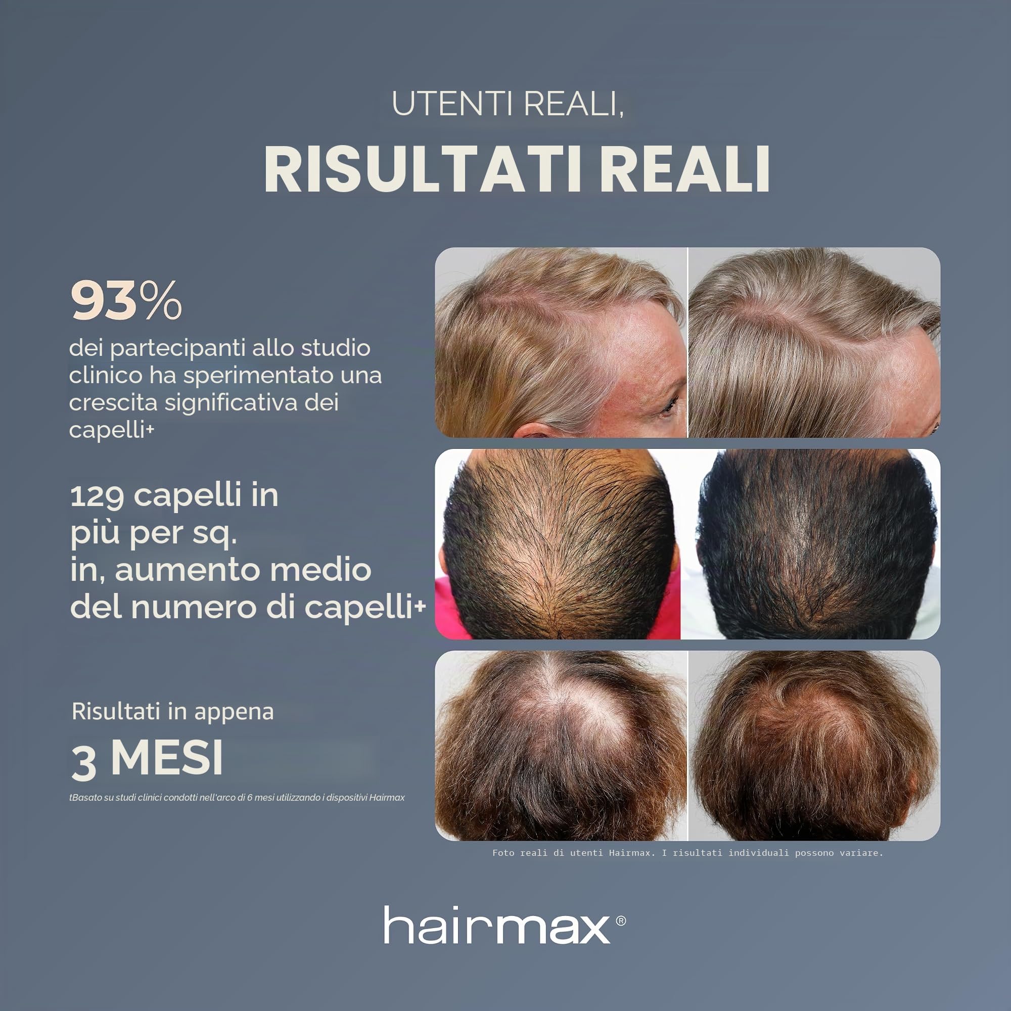 HairMax Ultima 9 LaserComb - Stimola la crescita dei capelli, li rende più spessi, più forti e più lucenti