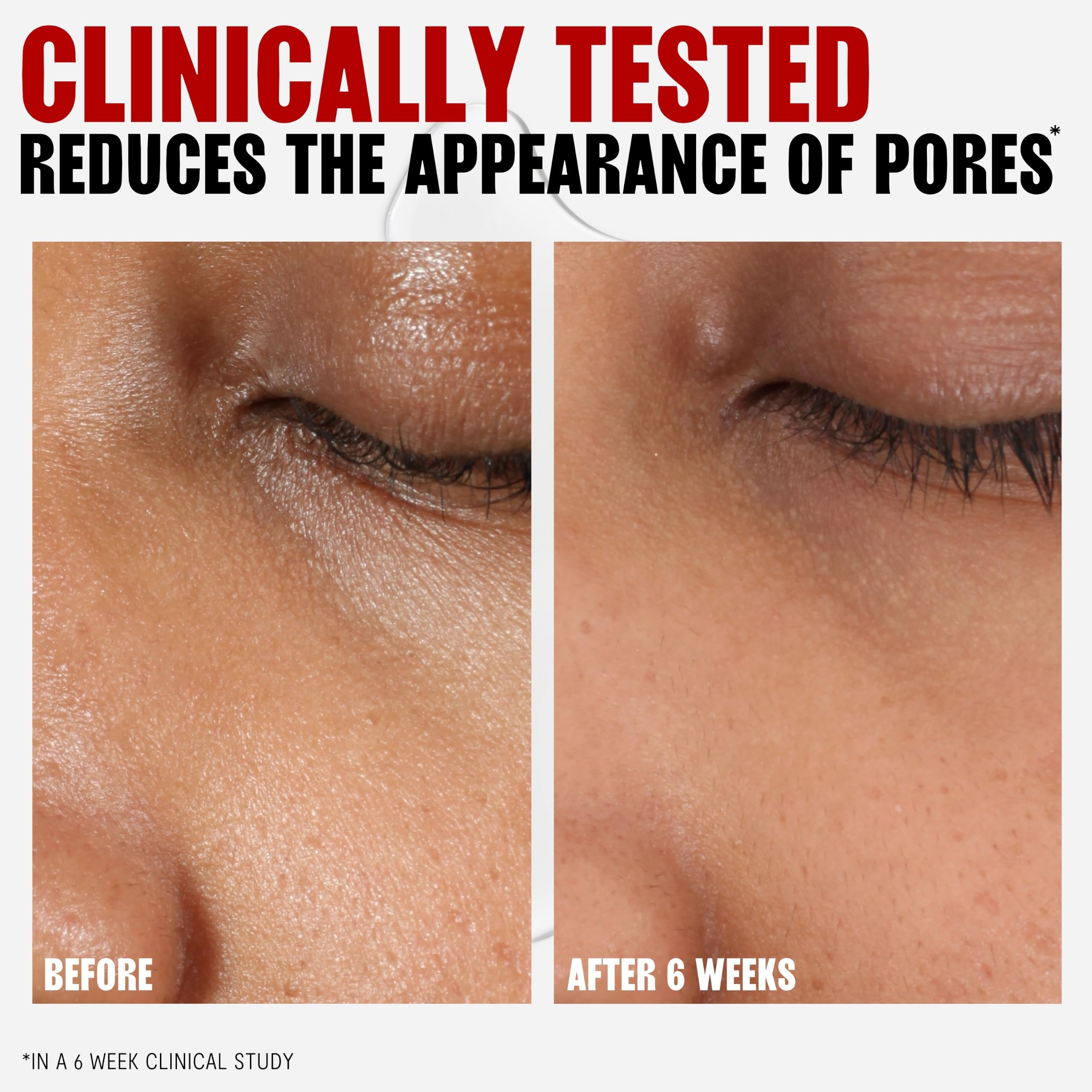 THAYERS Alkolsüz, Aloe Vera Formüllü Nemlendirici Orijinal Cadı Hazel Yüz Toneri, Vegan, Dermatolog Test Edildi ve Önerildi, 12 oz