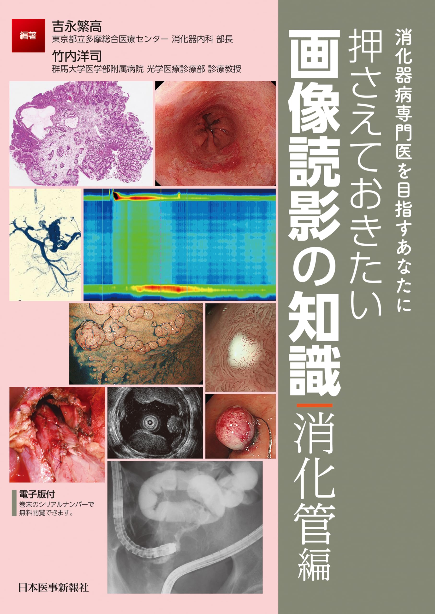 消化器病専門医を目指すあなたに 押さえておきたい画像読影の知識 消化