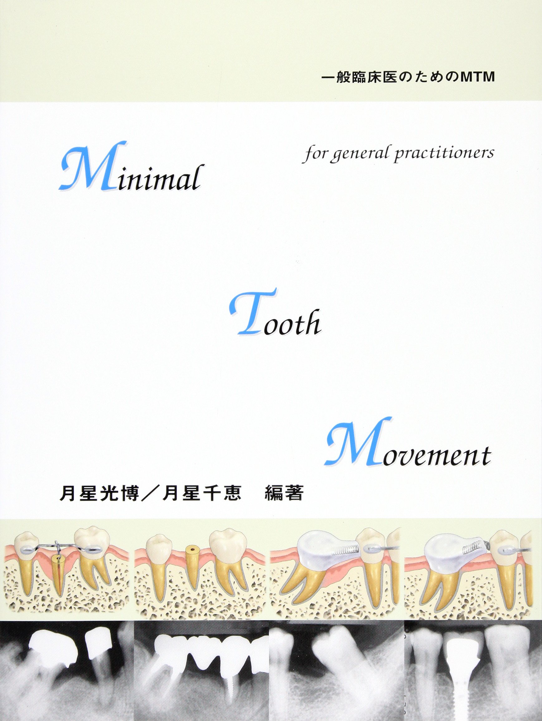 Minimal tooth movement: 一般臨床医のためのMTM | 月星 光博, 月星