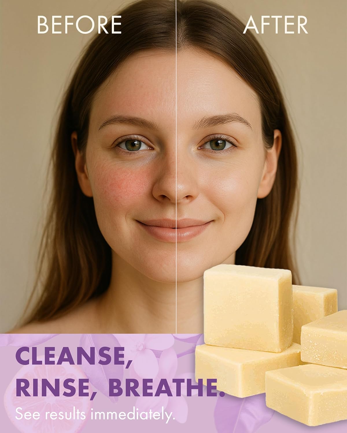 Massey’s CF 100% Natural Probiotic Soap - Powerful Tea Tree and Lemon Body Soap - 4oz Lemon Scent