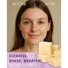 Candida Freedom Masseys CF 100% Natural Probiotic Soap - Powerful Tea Tree and Lemon Body Soap - 4oz Lemon Scent