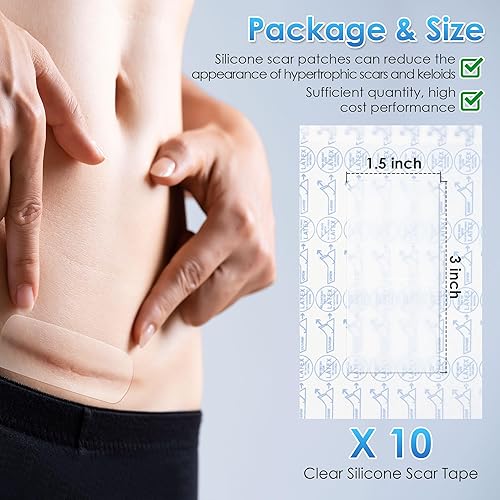 Miniatura 3 de Geiserailie 10 cintas de silicona transparente para cicatrices, tiras de silicona de grado médico, 1.5 x 3 pulgadas, parches de cicatrices para