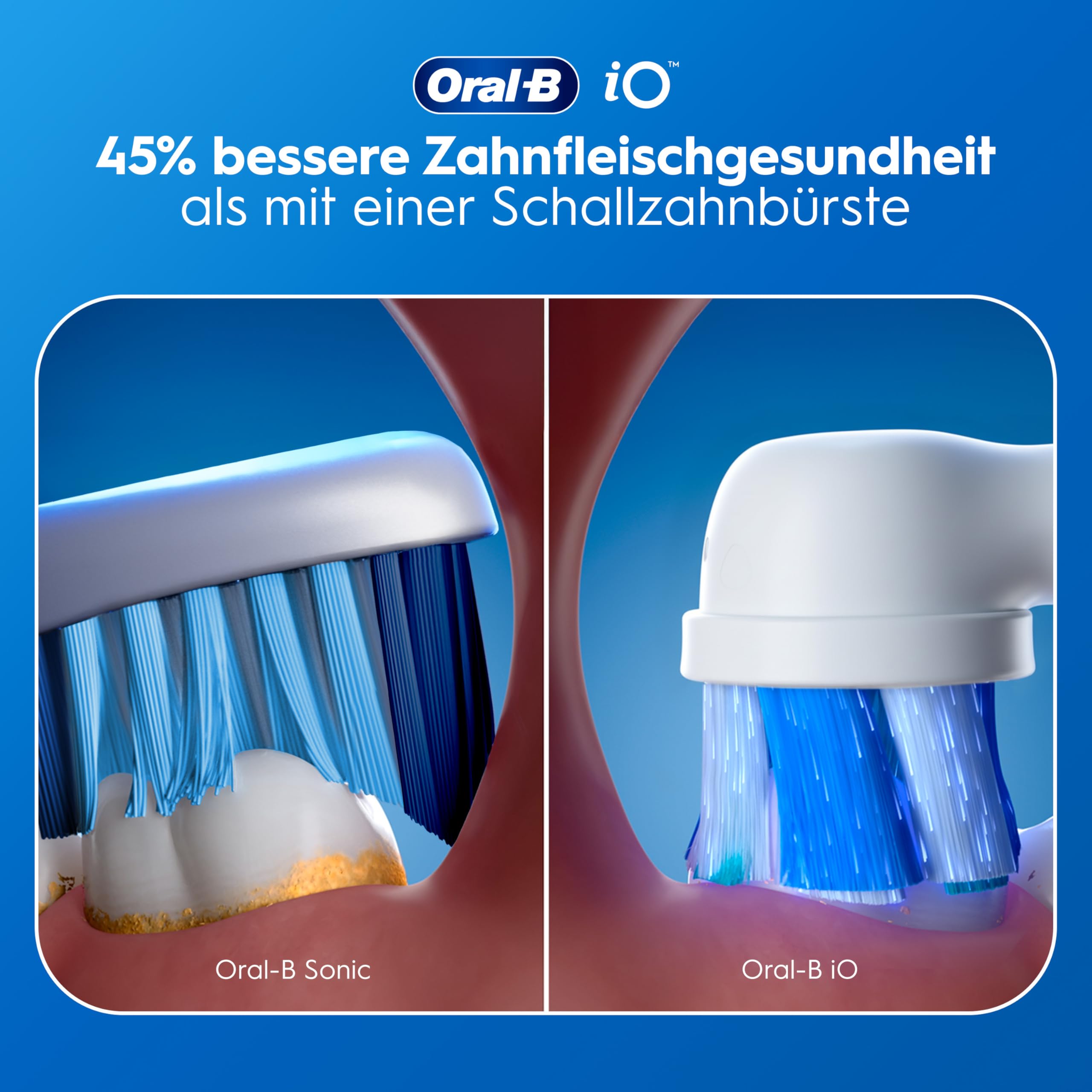 Oral-B iO Series 2 Elektrische Zahnbürste Rosa PLUS Original Oral-B iO Sanfte Reinigung Aufsteckbürste Weiß 3x