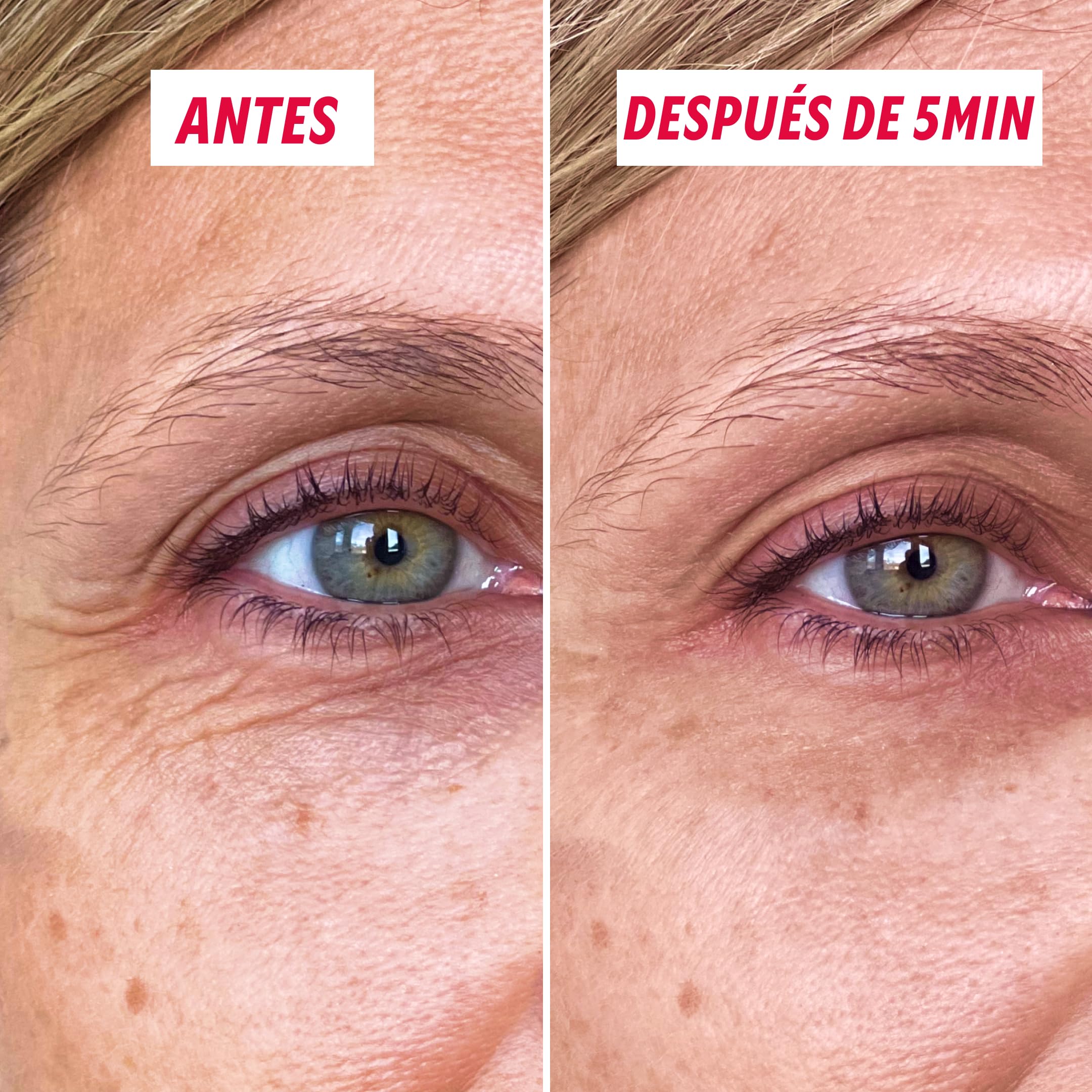 Rellenador de Arrugas - Corrector de Bolsas y Arrugas MYSOSBEAUTY – Crema Lifting Temporal Contorno de Ojos Anti-Edad – Efecto Lifting Instantáneo durante 8 h – Reduce Bolsas Bajo los Ojos (30 ml)