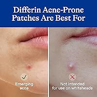 Vista 3 de Parches para el acné Differin, parches para espinillas para piel propensa al acné, formulados con ácido salicílico y centella, parche de triple